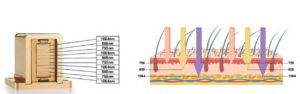 How 808nm Diode Laser Work To Hair Removal