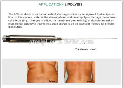 Application for Lipolysis