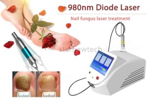 Diode Laser Machine For Nail Fungus Treatment