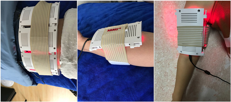 Lipo Laser Slimming Treatment