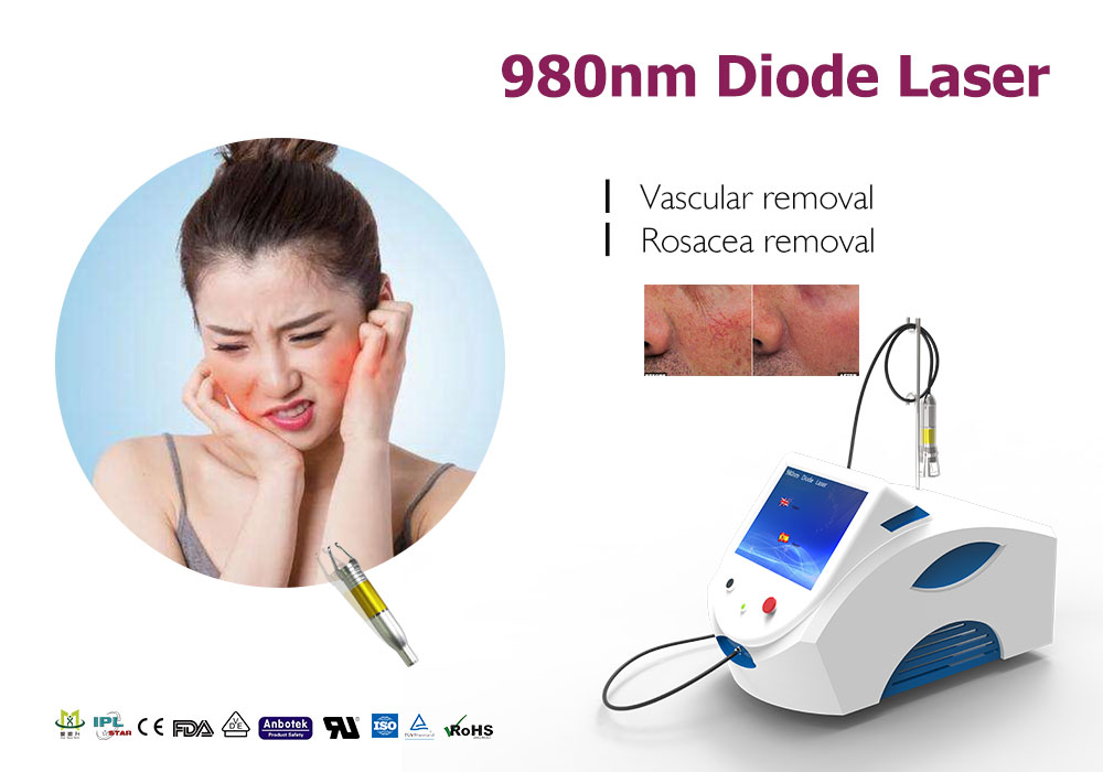 DIode Laser Machine Treat Spider Vein Problem