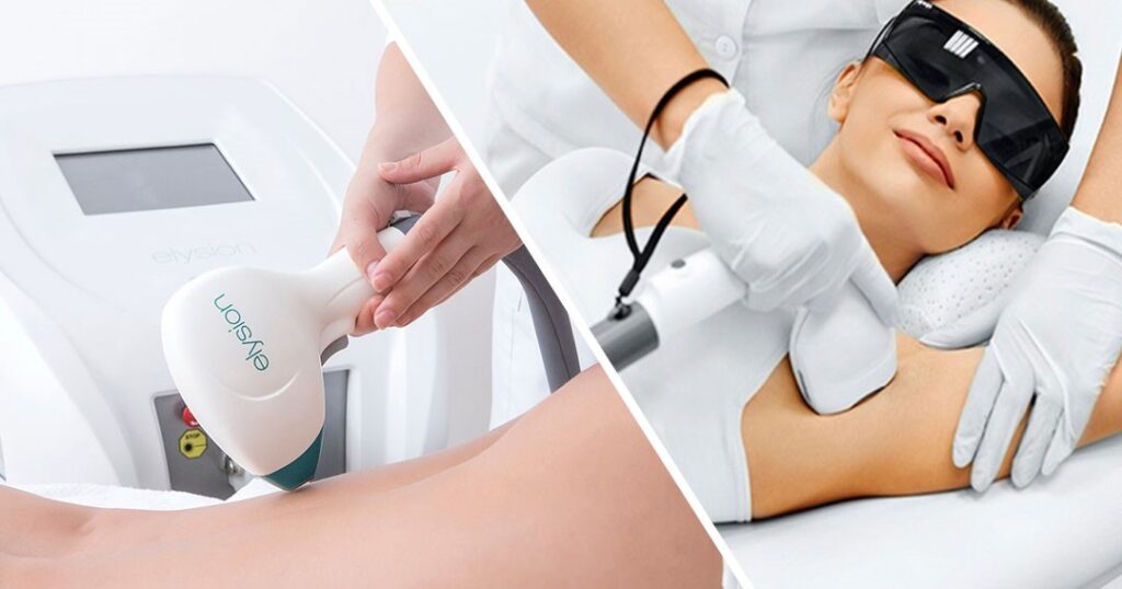 The Difference Between IPL And Diode Laser Hair Removal - Beijing