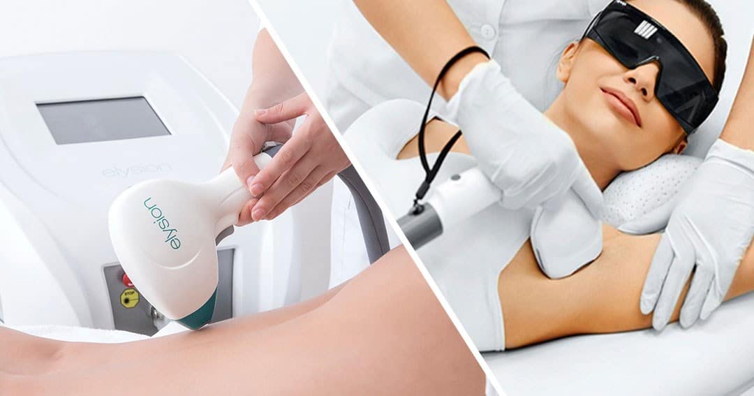 Laser Hair Removal