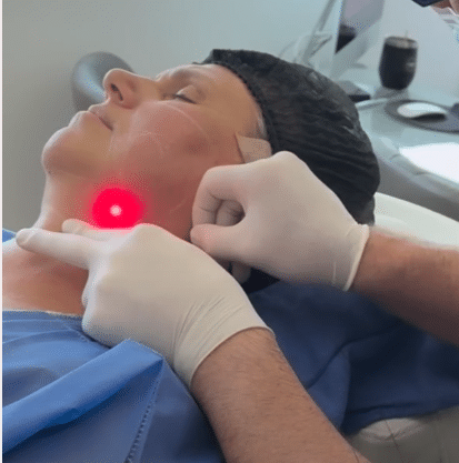 Procedure Photo
