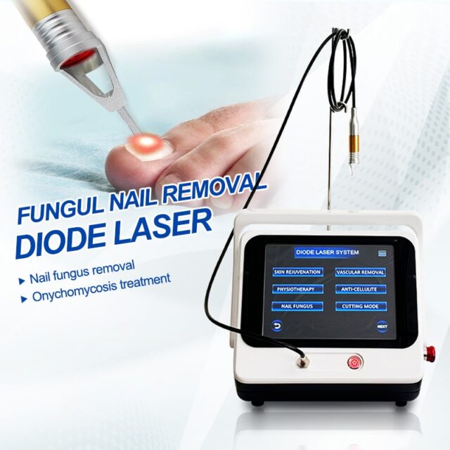 nail fungus removal laser